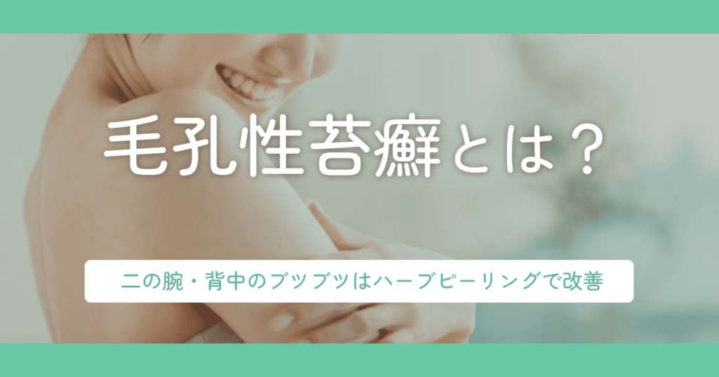 毛孔性苔癬とは？二の腕・背中のブツブツはハーブピーリングで改善