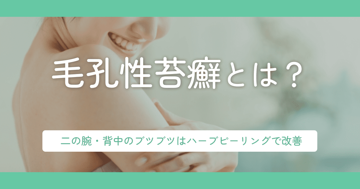 毛孔性苔癬とは?二の腕・背中のブツブツはハーブピーリングで改善