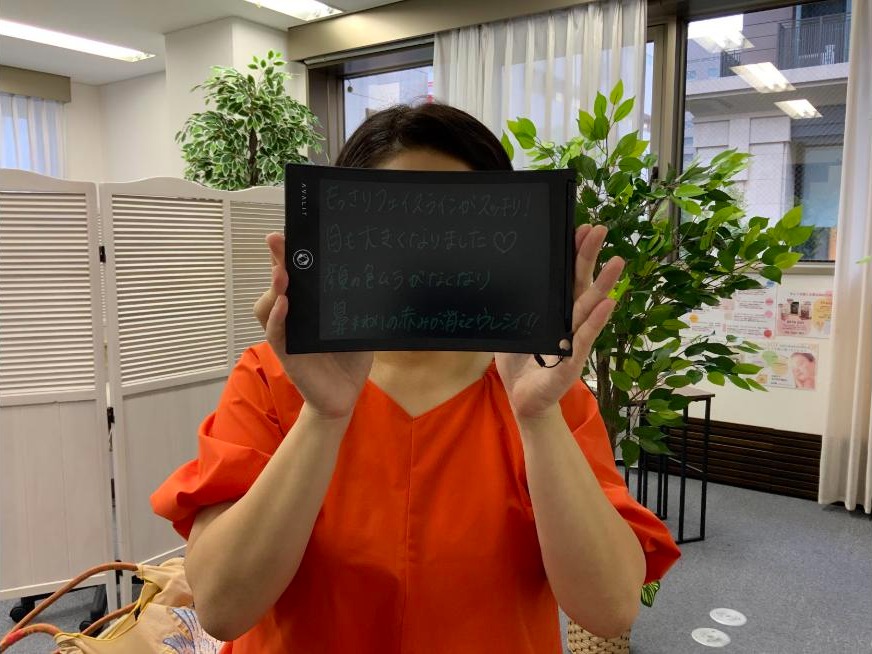ソフト施術後のお客様の感想ボード。もっさりフェイスラインがスッキリ、目も大きくなりました、顔の色ムラがなくなり、鼻まわりの赤みが消えてウレシイ